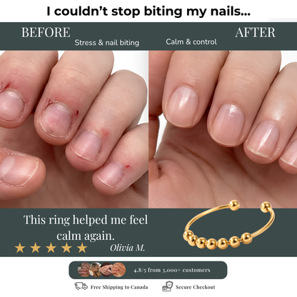 Calming Motion Ring